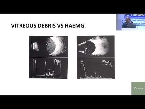 AIOS2025-IC503-Diagnostics in Medical Retina Recent Advances